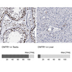 Anti-CMTR1 Antibody