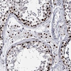 Immunohistochemical staining of human testis shows high expression.