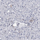 Immunohistochemical staining of human liver shows low expression as expected.