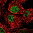Immunofluorescent staining of human cell line A-431 shows localization to nucleoplasm.