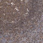 Immunohistochemical staining of human tonsil shows moderate to strong membranous positivity in lymphoid cells.