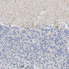 Immunohistochemical staining of human cerebellum shows moderate positivity in nuclear speckles in Purkinje cells.