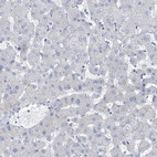 Immunohistochemical staining of human liver shows no positivity in hepatocytes as expected.
