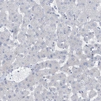 Immunohistochemical staining of human liver shows no positivity in hepatocytes as expected.