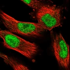 Immunofluorescent staining of human cell line U-251 MG shows localization to nucleoplasm.