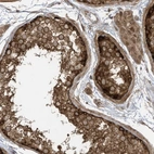 Anti-REPS1 Antibody