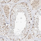 Anti-NHSL1 Antibody
