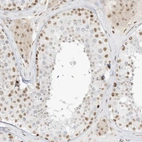 Anti-NHSL1 Antibody