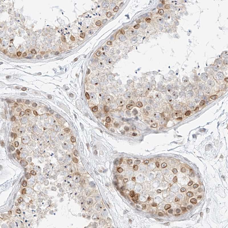 Anti-NHSL1 Antibody