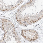Anti-NHSL1 Antibody