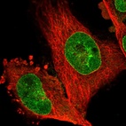 Immunofluorescent staining of human cell line U-251 MG shows localization to nucleoplasm & nuclear membrane.