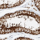 Anti-NHSL1 Antibody