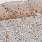 Immunohistochemical staining of human cervix, uterine shows moderate to strong nuclear positivity in squamous epithelial cells.