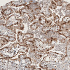 Anti-RECQL5 Antibody