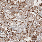 Anti-RECQL5 Antibody