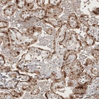 Immunohistochemical staining of human placenta shows no positivity in stromal cells as expected.
