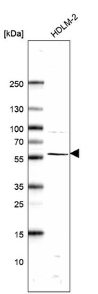 Anti-ABI1 Antibody