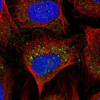 Immunofluorescent staining of human cell line U-2 OS shows localization to plasma membrane, cytosol & cell junctions.