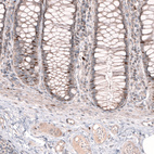 Anti-FOXM1 Antibody