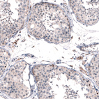 Anti-FOXM1 Antibody