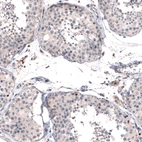 Immunohistochemical staining of human testis shows moderate nuclear positivity in few cells in seminiferous ducts.