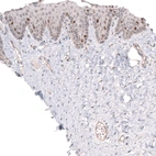 Immunohistochemical staining of human uterine cervix shows moderate nuclear positivity in a subset of epidermal cells.