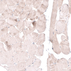 Immunohistochemical staining of human skeletal muscle shows no nuclear positivity in striated muscle fibers as expected.