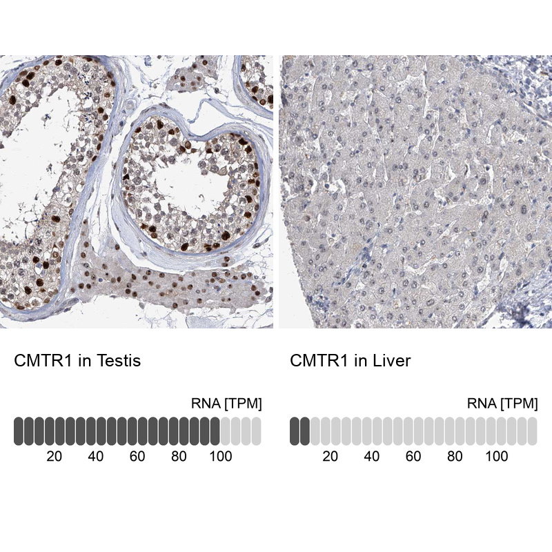 Anti-CMTR1 Antibody