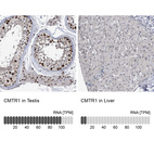 Anti-CMTR1 Antibody