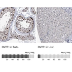 Anti-CMTR1 Antibody