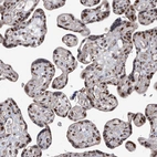 Immunohistochemical staining of human placenta shows strong nuclear and nucleolar positivity in trophoblastic cells.