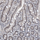 Immunohistochemical staining of human duodenum shows strong nucleolar positivity in glandular cells.