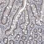 Immunohistochemical staining of human duodenum shows strong nucleolar positivity in glandular cells.