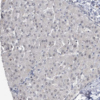 Immunohistochemical staining of human liver shows weak nucleolar positivity in hepatocytes.