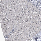 Immunohistochemical staining of human liver shows weak nucleolar positivity in hepatocytes.