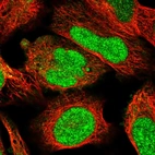 Immunofluorescent staining of human cell line U-2 OS shows localization to nucleoplasm.