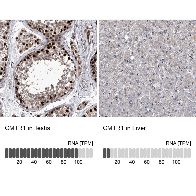 Anti-CMTR1 Antibody
