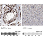Anti-CMTR1 Antibody