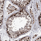 Immunohistochemical staining of human testis shows strong nuclear positivity in cells in seminiferous ducts.