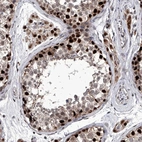 Immunohistochemical staining of human testis shows strong nuclear positivity in cells in seminiferous ducts.
