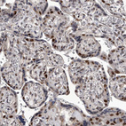 Immunohistochemical staining of human placenta shows moderate to strong nuclear positivity in trophoblastic cells.