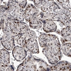 Immunohistochemical staining of human placenta shows moderate to strong nuclear positivity in trophoblastic cells.