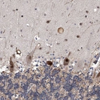 Immunohistochemical staining of human cerebellum shows moderate to strong nuclear positivity in Purkinje cells.