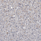 Immunohistochemical staining of human liver shows no positivity in hepatocytes as expected.