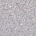 Immunohistochemical staining of human liver shows no positivity in hepatocytes as expected.