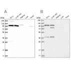 Western blot analysis using Anti-CMTR1 antibody HPA029980 (A) shows similar pattern to independent antibody HPA029979 (B).