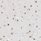Immunohistochemical staining of human cerebral cortex shows moderate to strong nuclear positivity in neuronal cells.