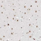 Immunohistochemical staining of human cerebral cortex shows moderate to strong nuclear positivity in neuronal cells.