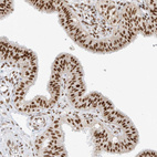 Immunohistochemical staining of human fallopian tube shows strong nuclear positivity in glandular cells.