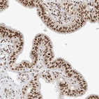 Immunohistochemical staining of human fallopian tube shows strong nuclear positivity in glandular cells.